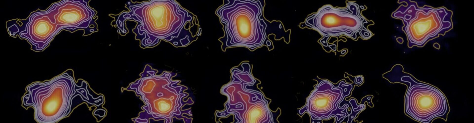 ALMA Reveals Hidden Structures in the First Galaxies of the Universe